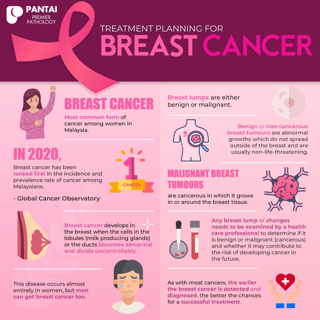 Treatment Planning for Breast Cancer – Premier Integrated Labs